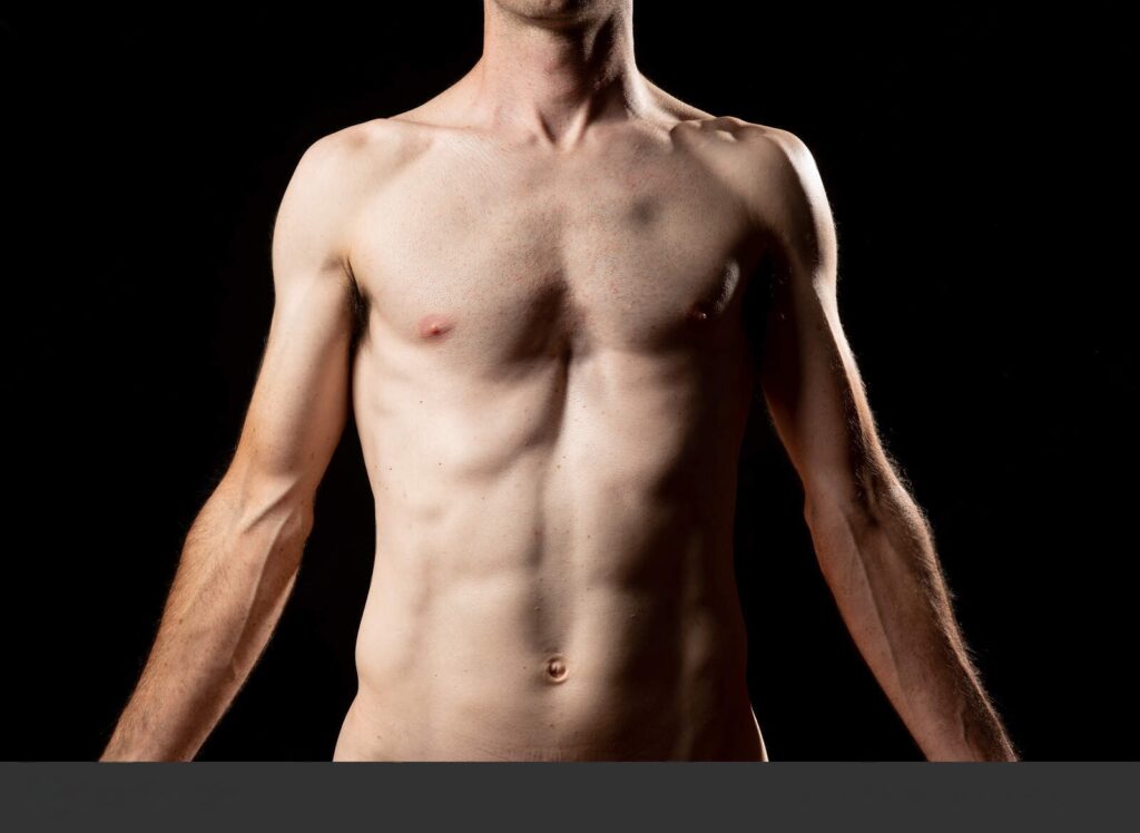 Joven con Pectus excavatum en Colombia recuperando su confianza y bienestar tras tratamiento médico. Símbolo de esperanza y salud torácica